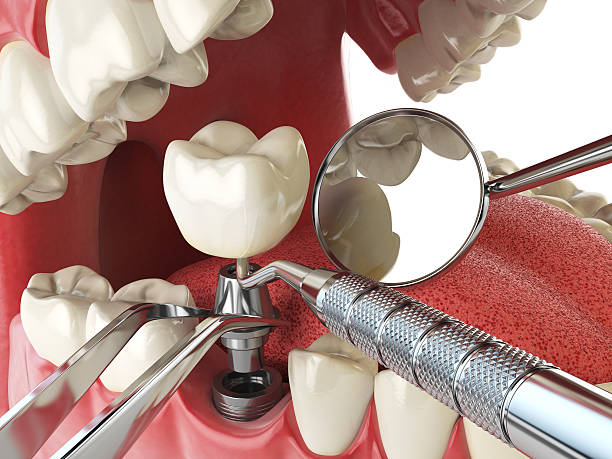 Best Urgent Care for Lost Fillings or Crowns in South Haven, IN